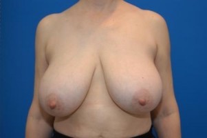 Simply Breasts